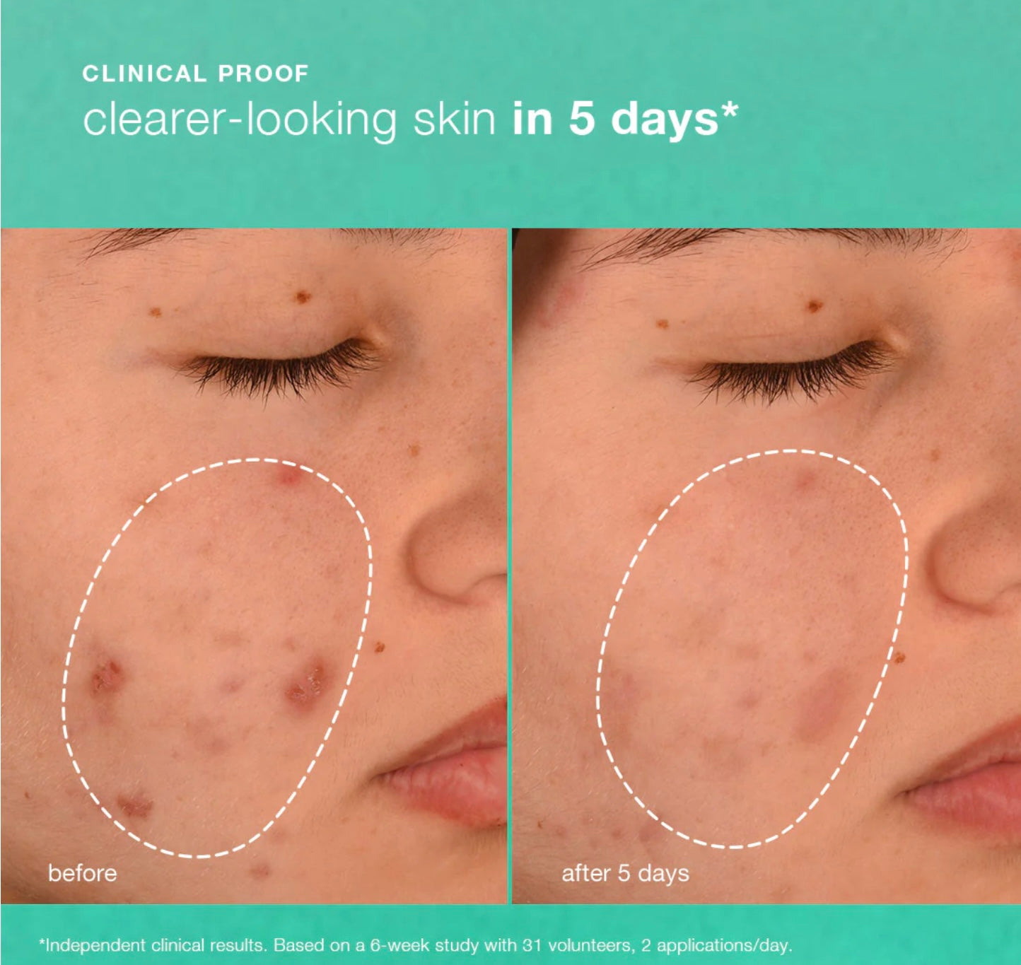 Breakout Biotic Moisturiser